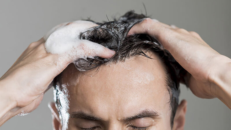Nguyên nhân gây rụng tóc ở nam giới