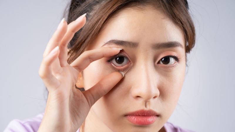 Cách phòng ngừa khô mắt vào mùa hè