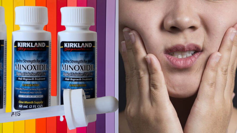 Nên dùng Minoxidil với nồng độ bao nhiêu?